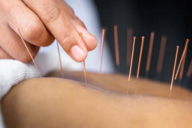 Akupunkturbehandling- Jadepoints akupunktur
